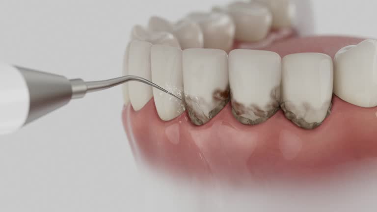 Reliable Dental contractor in Fort Myers Beach, FL by Dentist Open Now